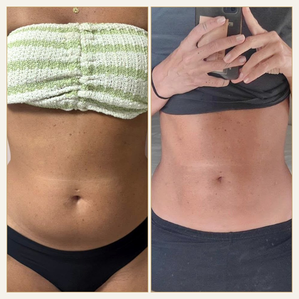 Antes & Depois